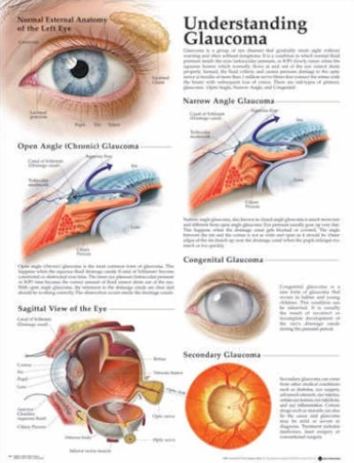 UNDERSTANDING GLAUCOMA LAMINATED WALL CHART