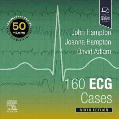 Book cover of '160 ECG Cases' with ECG waveform design on a green background