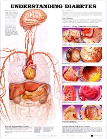 UNDERSTANDING DIABETES LAMINATED WALL CHART - Charles Darwin University Bookshop
