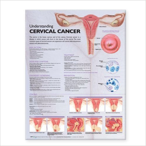 UNDERSTANDING CERVICAL CANCER LAMINATED WALL CHART - Charles Darwin University Bookshop
