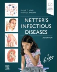NETTER&#39;S INFECTIOUS DISEASE