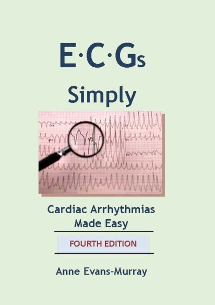 ECGS SIMPLY CARDIAC ARRHYTHMIAS MADE EASY 4TH EDITION